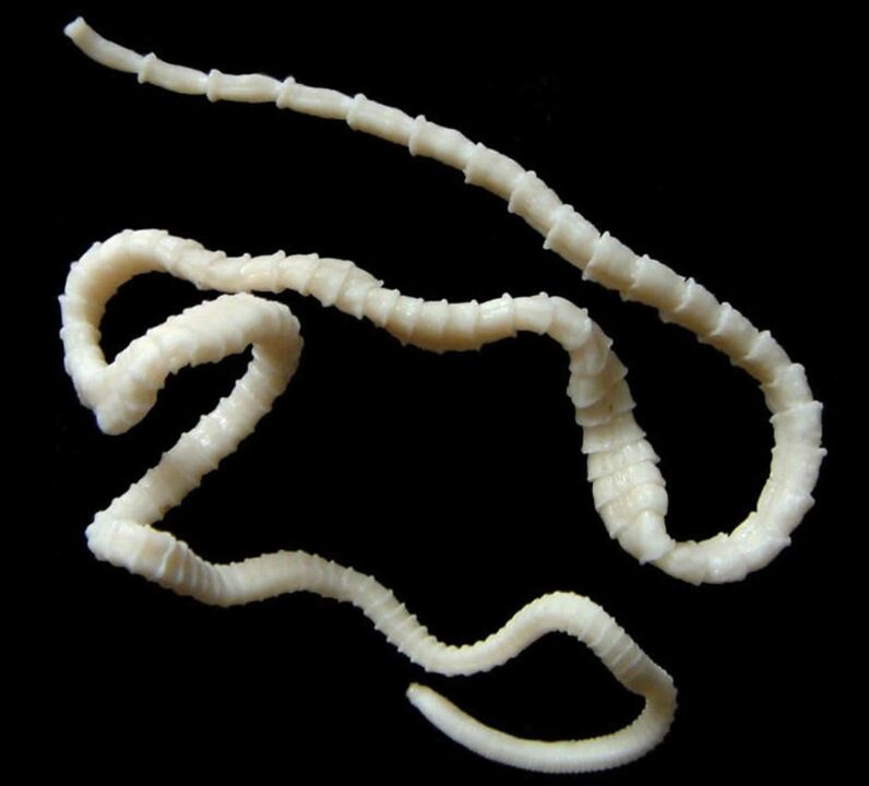 human tapeworm