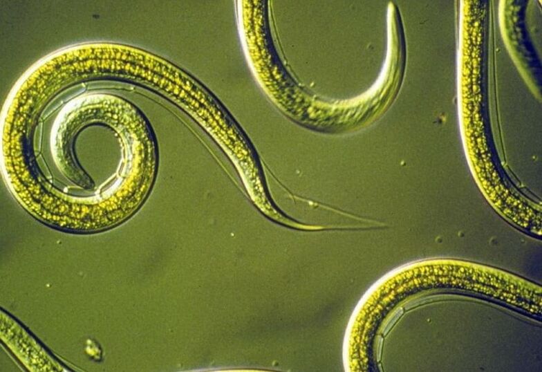 human body roundworms