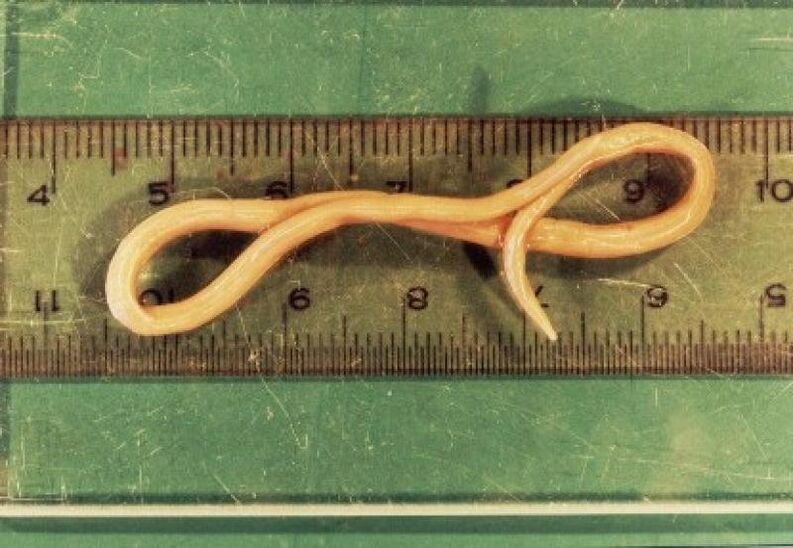 roundworm parasite of the human body