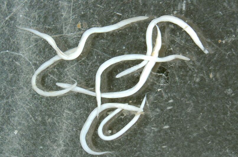 worm parasite of the human body