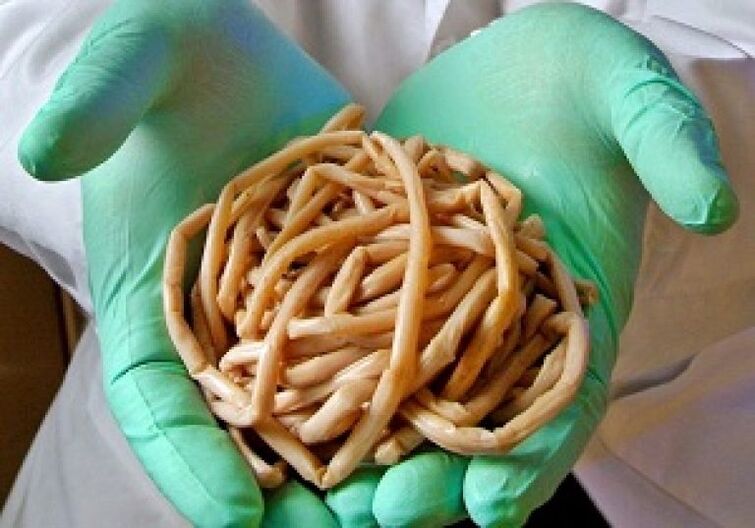 Parasitic worms in the human body