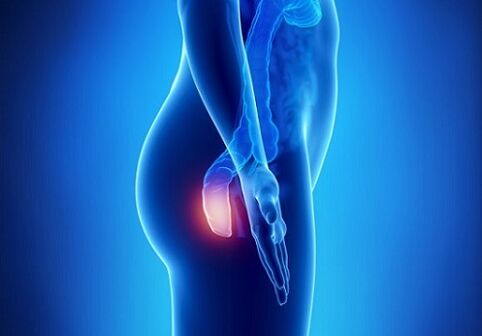 itching in the rectum as an indication for parasite testing