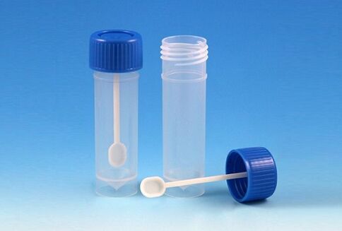 vial for analyzing feces for parasites
