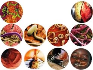 How to remove parasites from the body with folk remedies