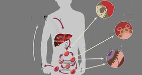 the appearance of parasites in the body