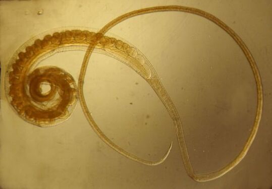Trichinella worm of the human body